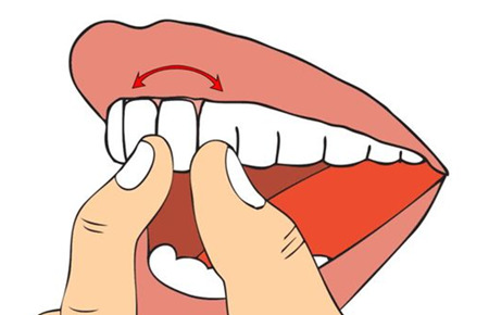 牙齿松动要及时治疗