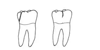 OMG，牙齿折断了怎么办？