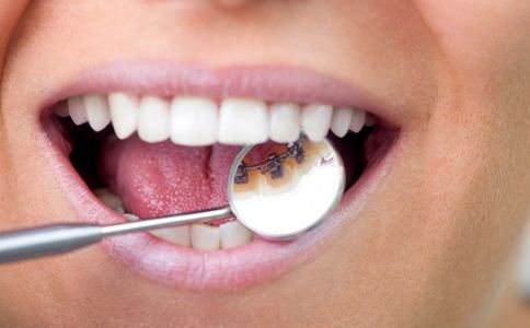 蛀牙的原因 蛀牙怎么办 哪些坏习惯导致蛀牙