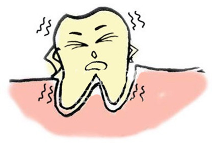 牙齿松动要及时治疗